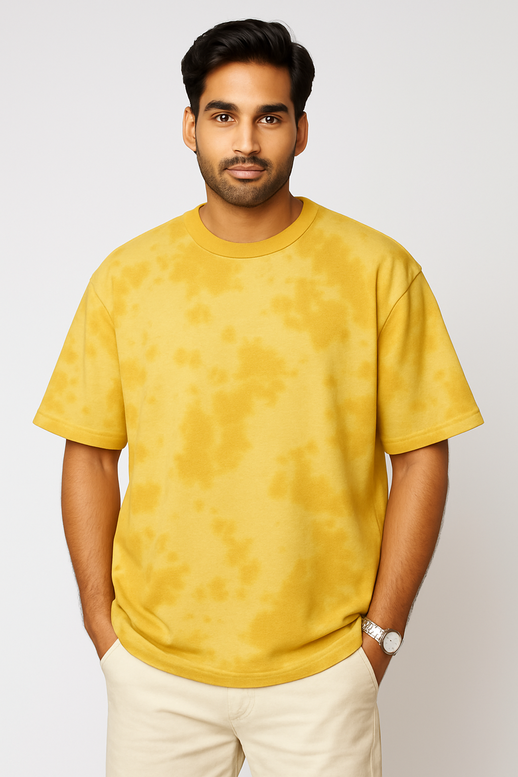 Alphahood Oversized Tie-Dye Tee – Yellow